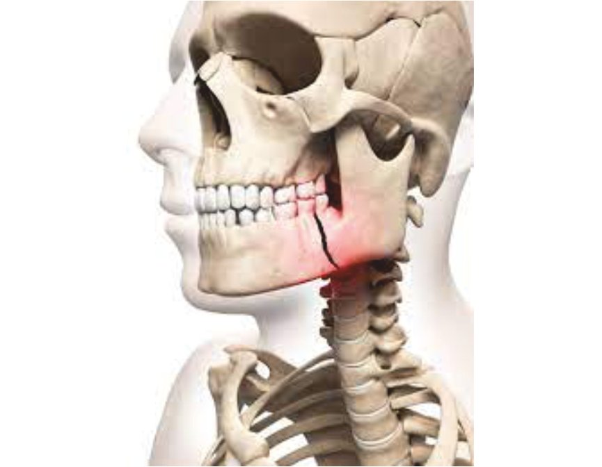 facial trauma1